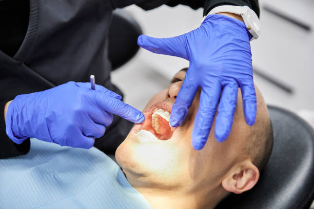 Best Tooth Infection Emergency Dentist  in Lake Shore, MD